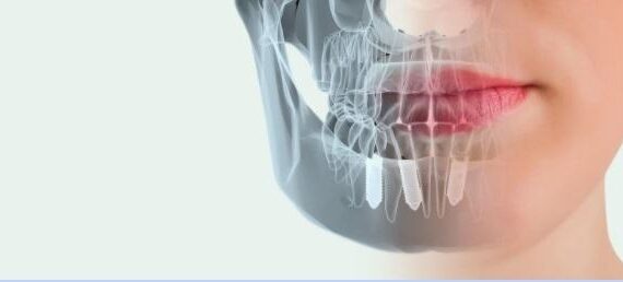 Clínica Dental Herrera apuesta por la tecnología de vanguardias