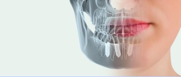 Clínica Dental Herrera apuesta por la tecnología de vanguardias