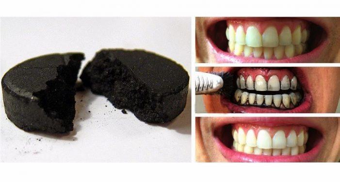 Advirten dos riscos de branquear os dentes con carbón activado