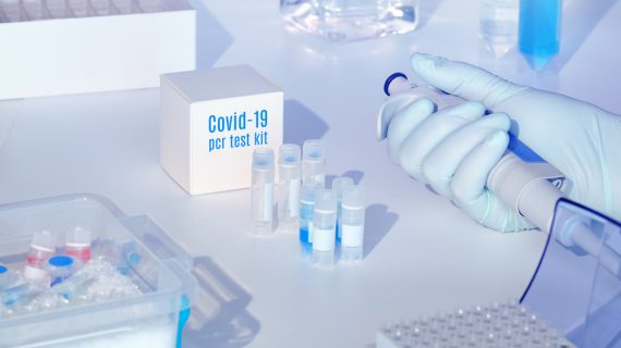 España ha realizado más de 2,2 millones de PCR desde el inicio de la epidemia