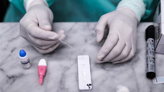 España supera las 1.600.000 pruebas diagnósticas PCR realizadas