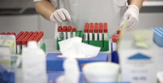 Galicia, primeira comunidade autónoma que detecta en España a presenza da variante sudafricana da COVID19 en Vigo