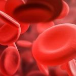 La hemofilia, la enfermedad rara más común
