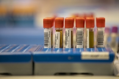 La Xunta almacenará en el Centro de Supercomputación de Galicia los datos de cerca de 30.000 análisis genómicos de pacientes que realiza al año